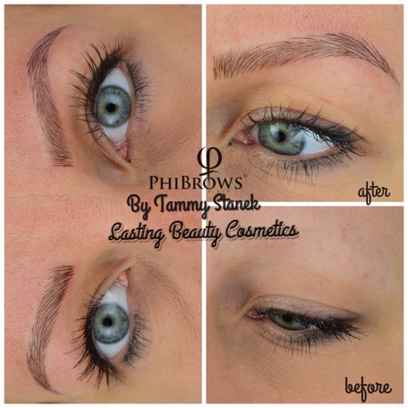 Microblading Alopecia Madison, by Lasting Beauty Cosmetics 