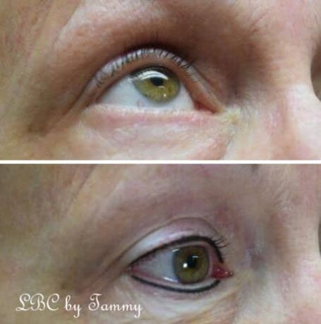 Tammy Stanek Certified Pigmentation Dermal Artist