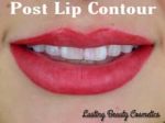Post Lip Contour