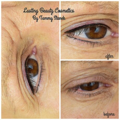 Permanent eyeliner treatment madison wi