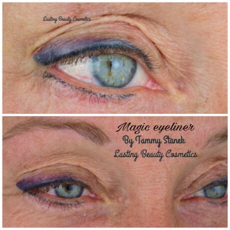 madison eyeliner treatment